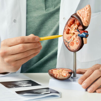 4 signs of kidney disease due to excess sugar consumption