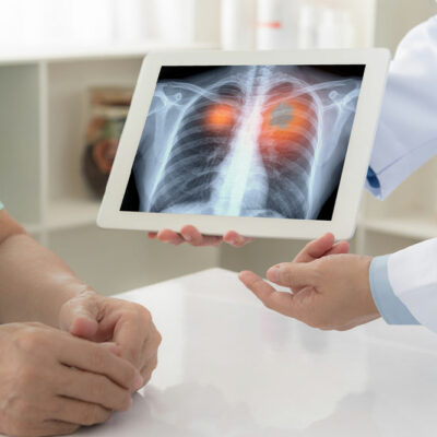 6 signs that indicate a lung disease