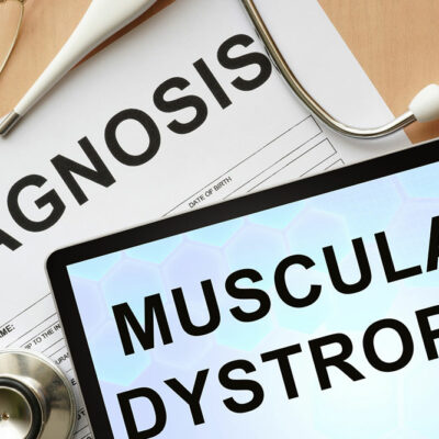 Muscular dystrophy &#8211; Warning signs and management